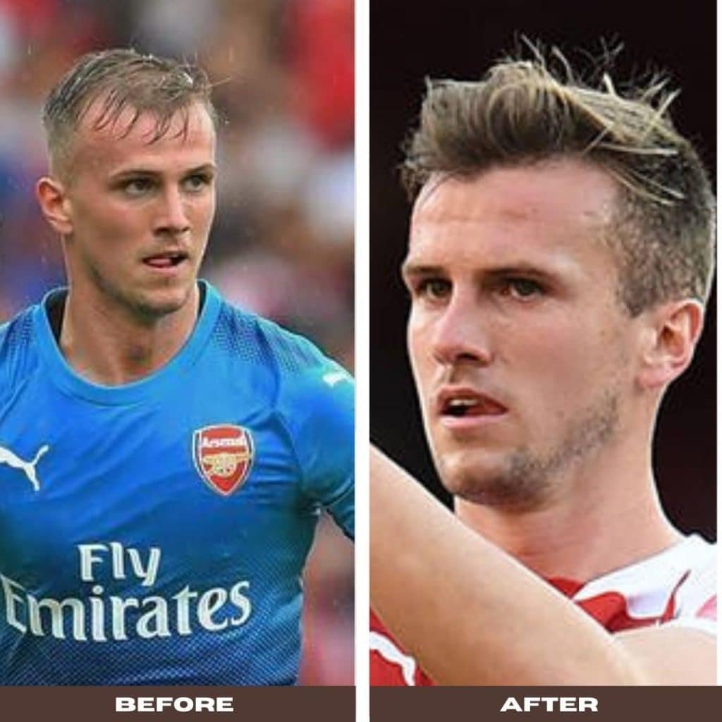 rob holding before after