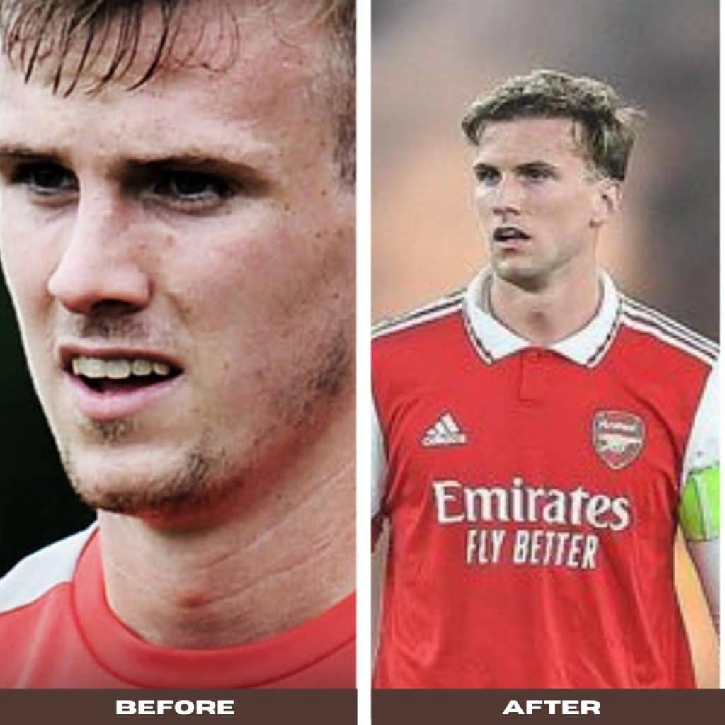 rob holding new hair