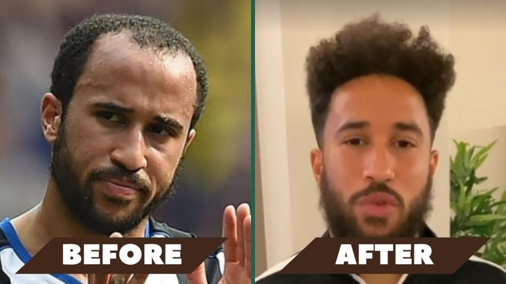 Andros Townsend hair