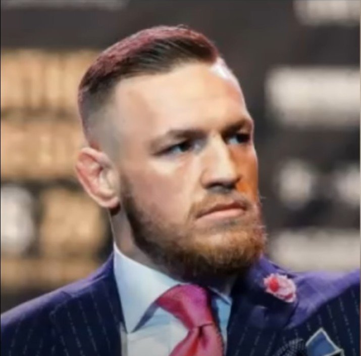 Conor McGregor's Hair transplant