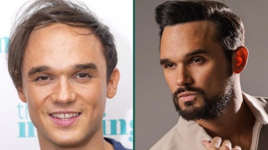 gareth gates hair