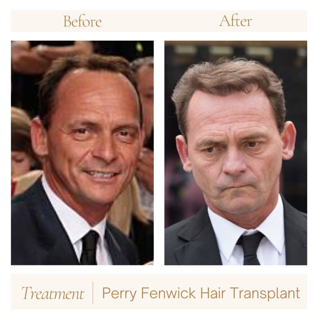 Perry Fenwick hair transformation