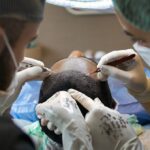 A list of 12 important factors to consider before undergoing a hair transplant, including the type and extent of hair loss, cost, the different types of procedures available, the reputation of the surgeon, the recovery process, potential risks and complications, long-term effects, non-surgical alternatives, expectations, and maintenance requirements.