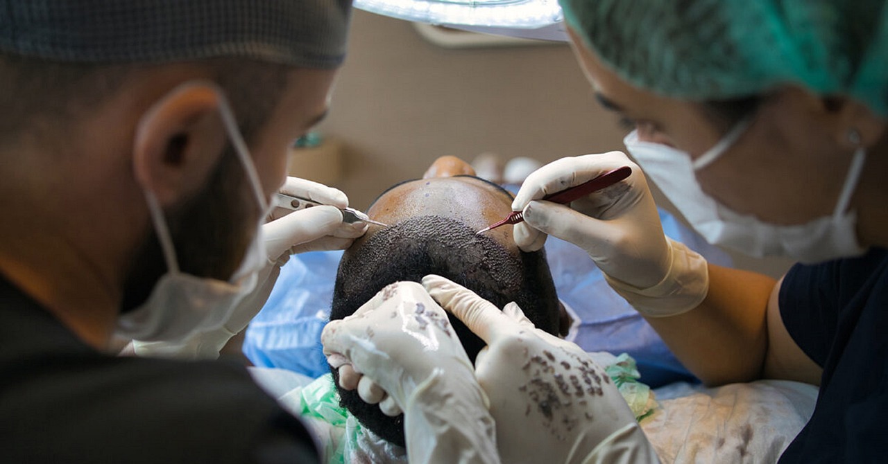 A list of 12 important factors to consider before undergoing a hair transplant, including the type and extent of hair loss, cost, the different types of procedures available, the reputation of the surgeon, the recovery process, potential risks and complications, long-term effects, non-surgical alternatives, expectations, and maintenance requirements.