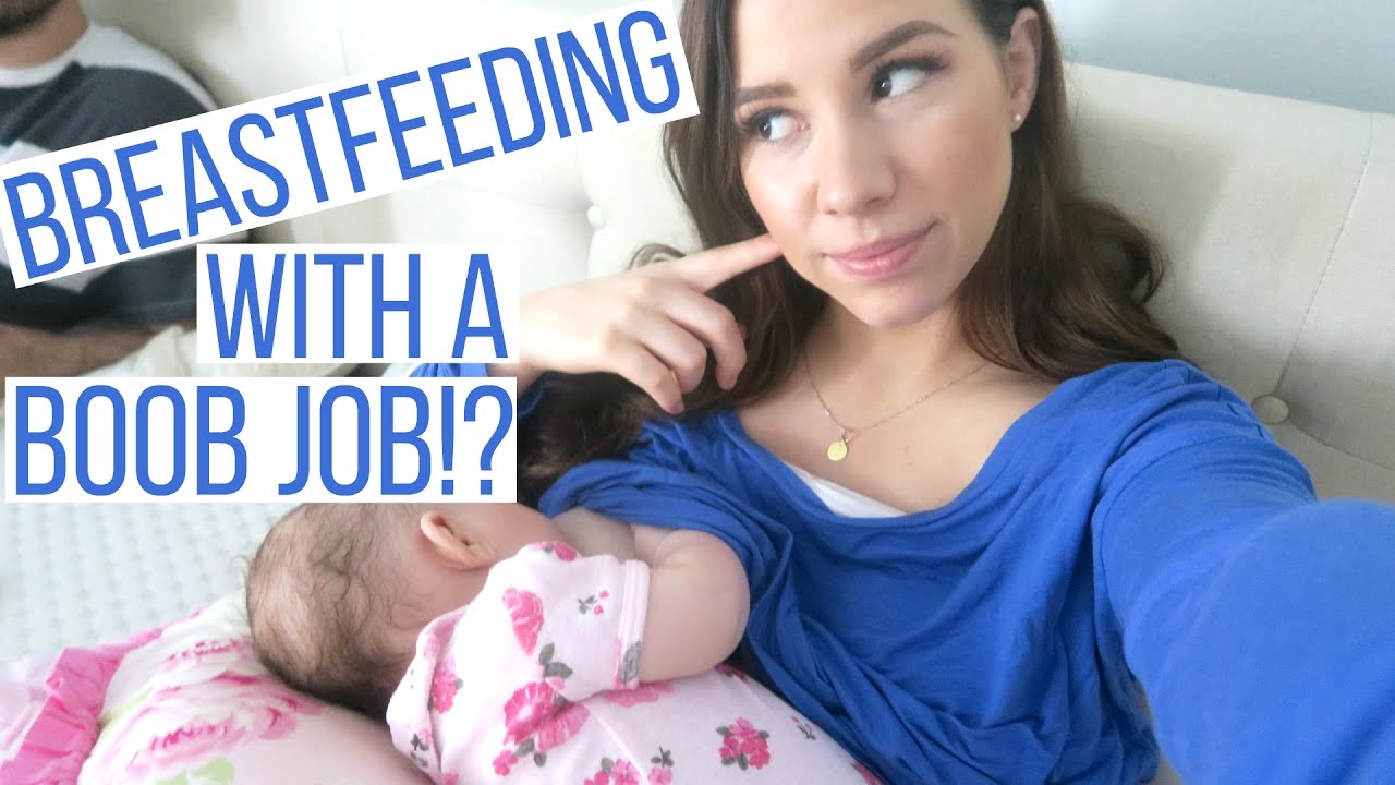 Breastfeed After a Breast Lift