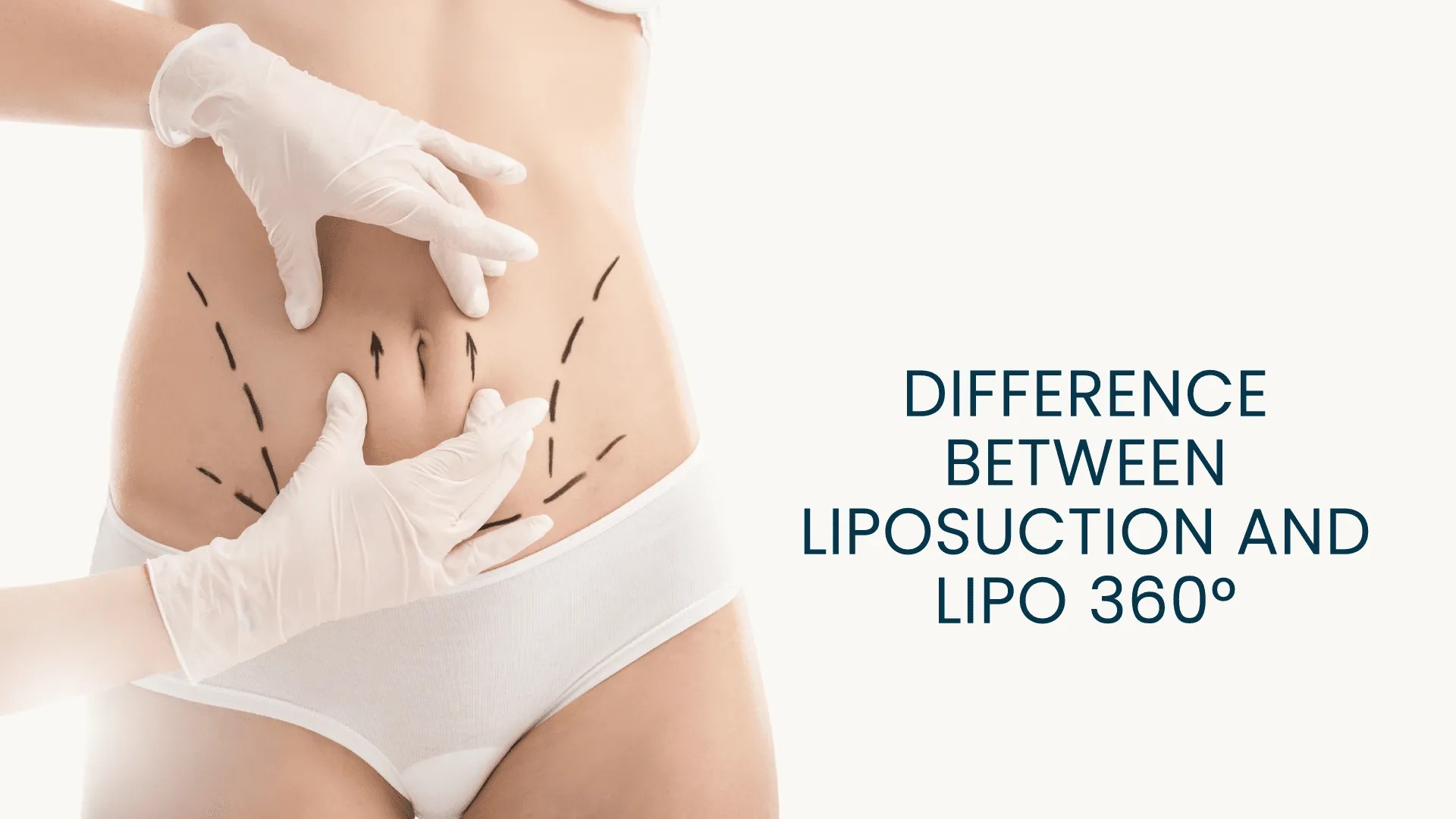 differences between 360 liposuction and lollipop liposuction
