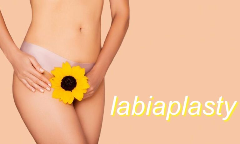 labiaplasty